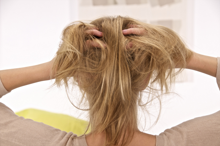Tips Mengatasi Rambut Lepek: 5 Cara Efektif