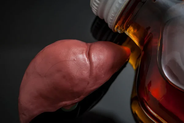 10 Tips Aman Konsumsi Alkohol Agar Tidak Merusak Hati 10 Tips Aman Konsumsi Alkohol Agar Tidak Merusak Hati