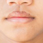 10 Cara Mengatasi Bibir Terlalu Kering Saat Flu