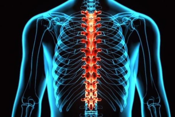 10 Hal Kecil yang Bisa Merusak Struktur Tulang Belakang