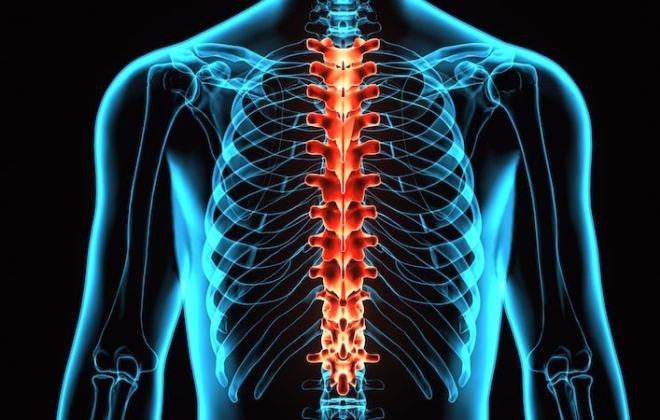 10 Hal Kecil yang Bisa Merusak Struktur Tulang Belakang