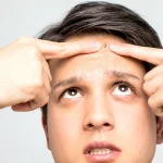 10 Cara Menjaga Kesehatan Kulit agar Terhindar dari Jerawat
